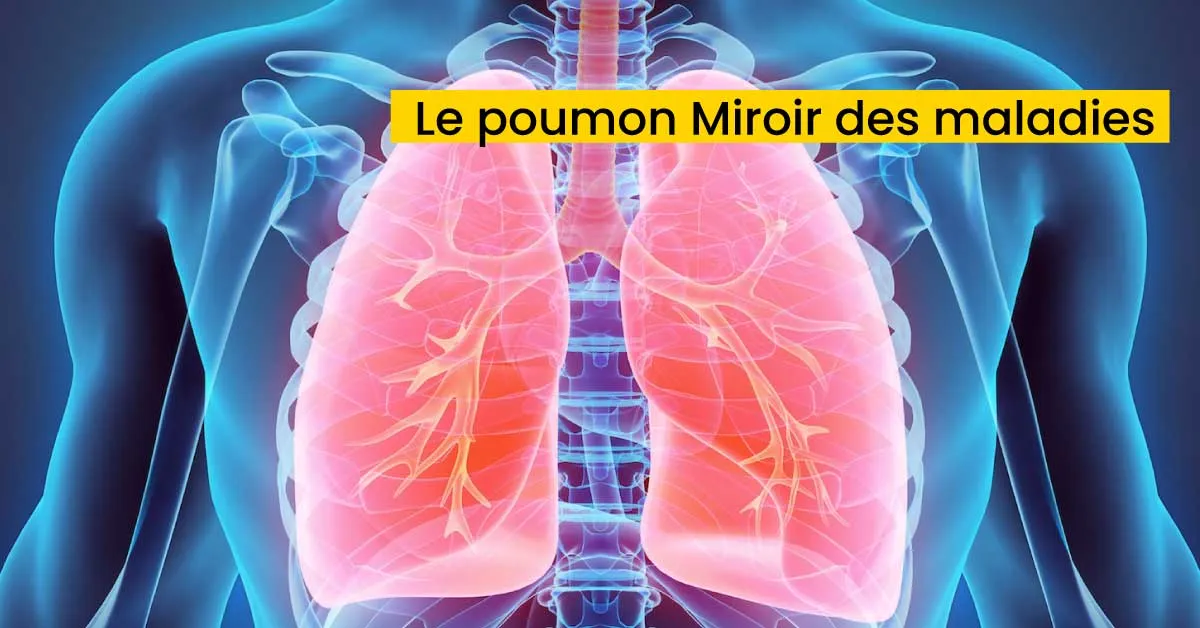 Le poumon Miroir des maladies
